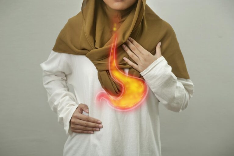Mengatasi GERD Naik dengan Cara yang Alami dan Efektif